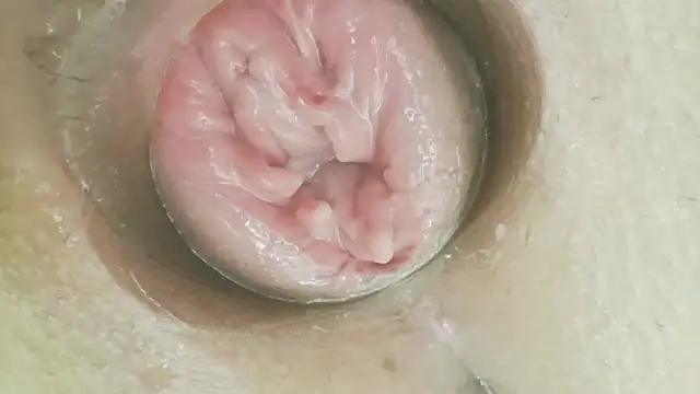 Karol_stom - five finger in asshole deep