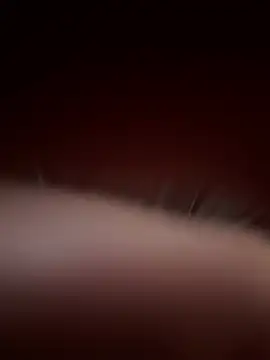 OddExample857 - Dp