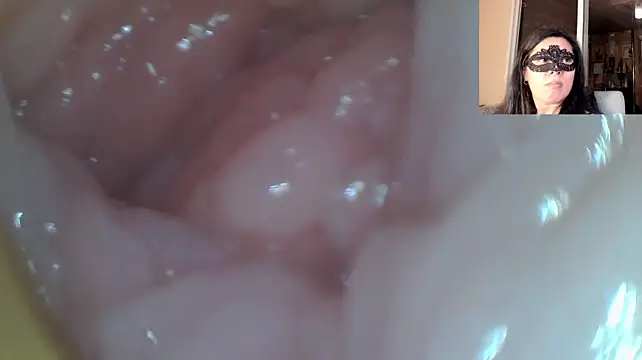Reinacatchile - Squirt