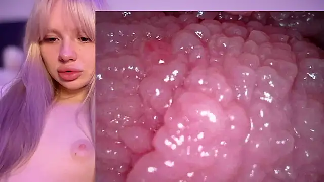 Jannemary - Show cervix