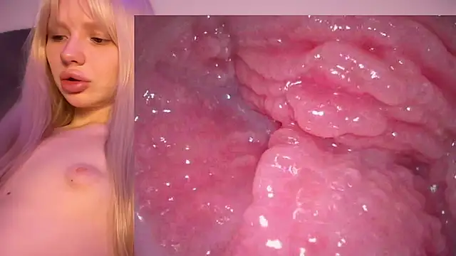 Jannemary - Show cervix