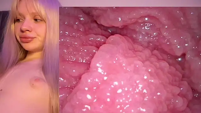 Jannemary - Show cervix