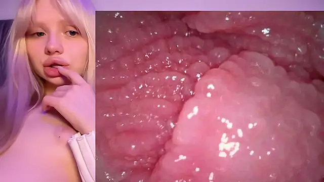 Jannemary - Show cervix