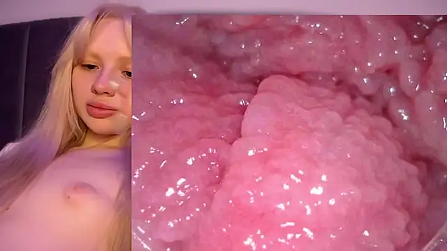 Jannemary - Show cervix