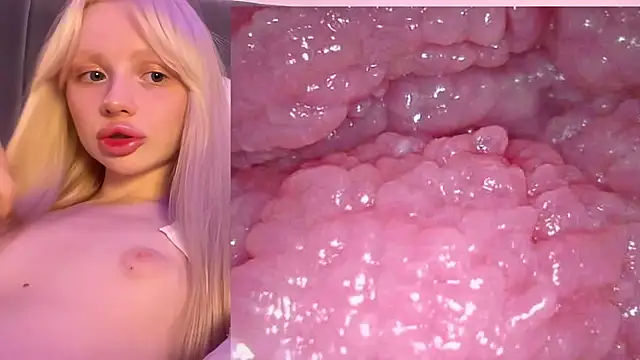 Jannemary - Show cervix