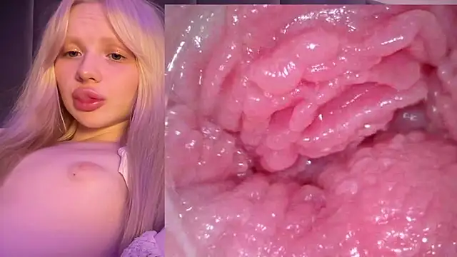 Jannemary - Show cervix
