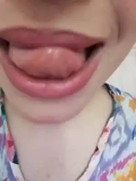 Kokkina22