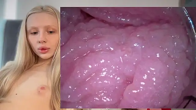 Jannemary - Show cervix