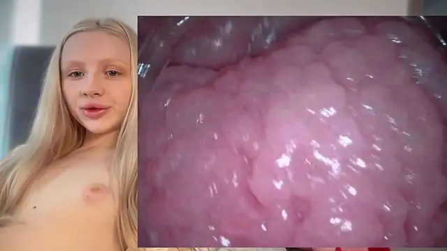 Jannemary - Show cervix