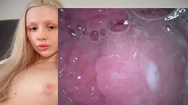 Jannemary - Show cervix