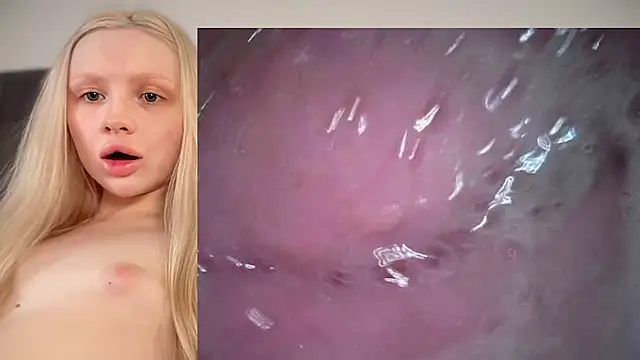 Jannemary - Show cervix