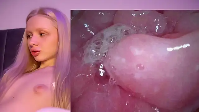 Jannemary - Show cervix