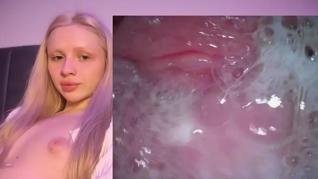 Jannemary - Show cervix