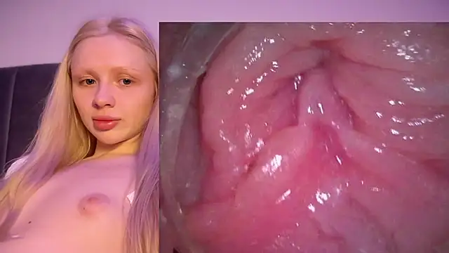 Jannemary - Show cervix