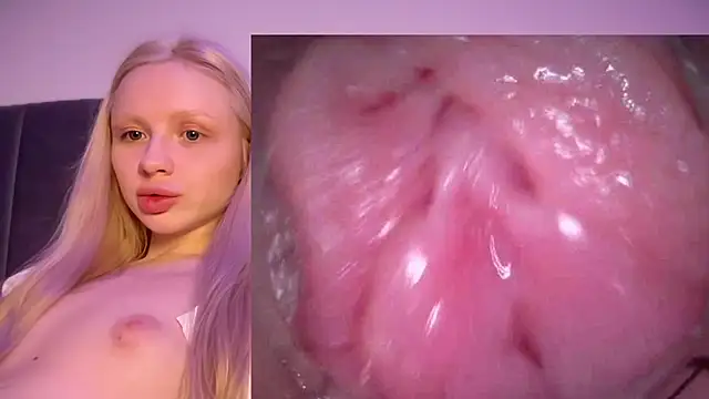 Jannemary - Show cervix