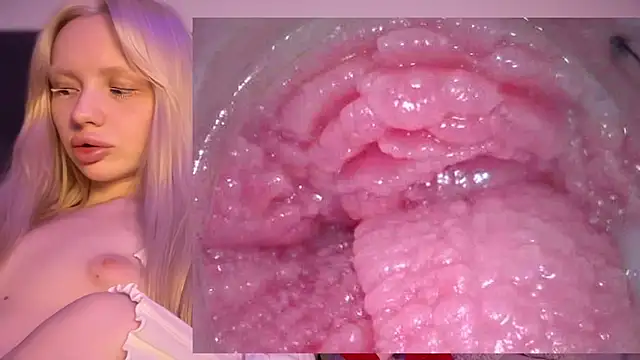 Jannemary - Show cervix