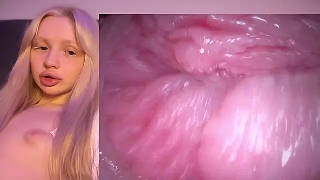 Jannemary - Show cervix