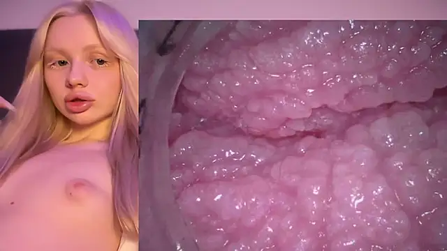 Jannemary - Show cervix