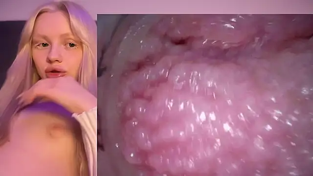 Jannemary - Show cervix