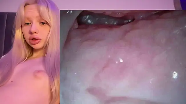 Jannemary - Show cervix