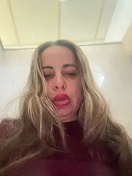 Laarti - Squit y anal