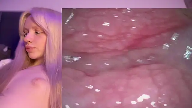 Jannemary - Show cervix