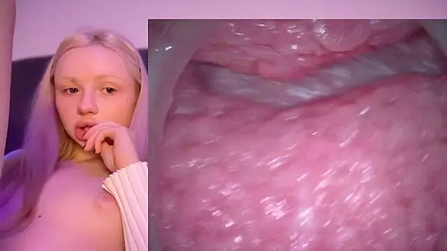 Jannemary - Show cervix