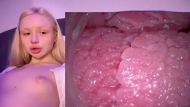 Jannemary - Show cervix
