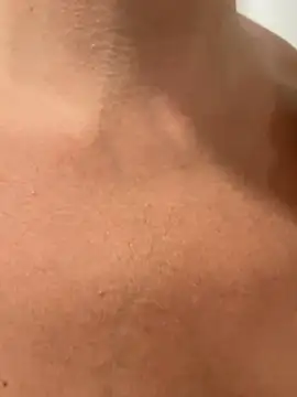 Anvessra