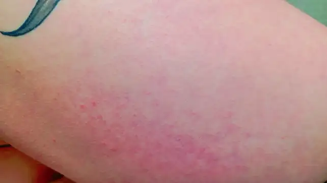 _Alison__