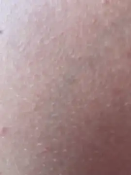 Anvessra - Show Tits