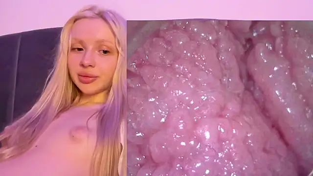 Jannemary - Show cervix