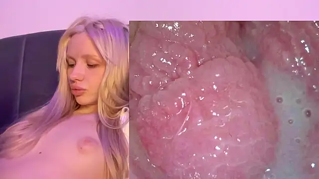Jannemary - Show cervix