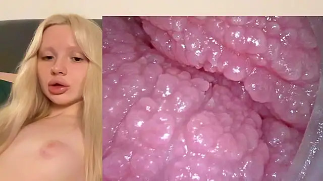 Jannemary - Show cervix