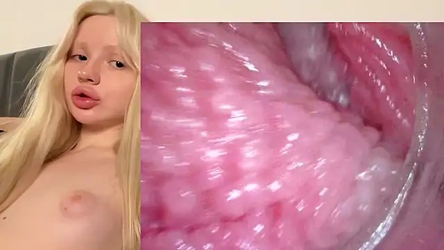 Jannemary - Show cervix