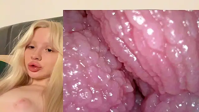 Jannemary - Show cervix