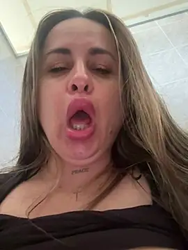 Laarti - Squit y anal