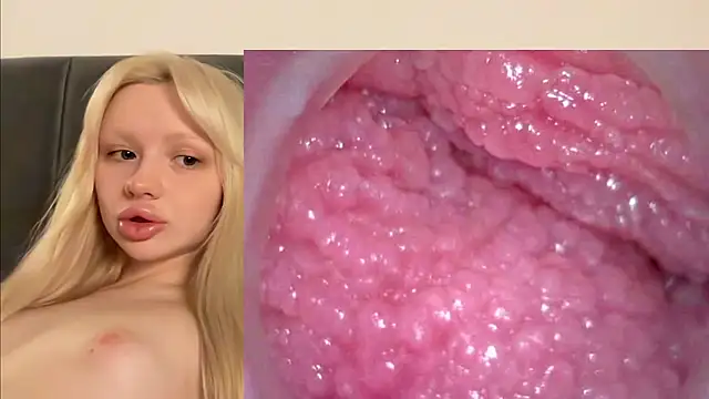 Jannemary - Show cervix